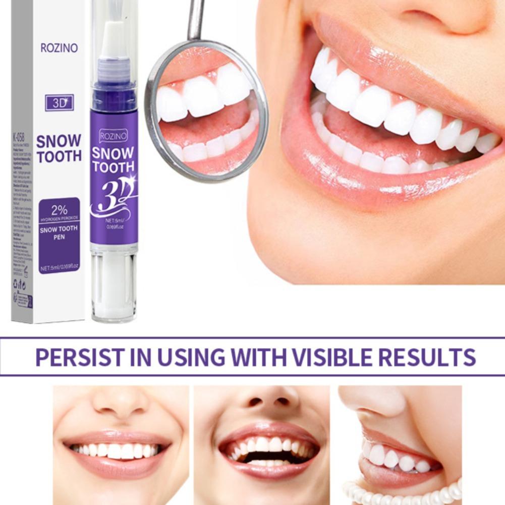Unisex mondverzorgingspen, ant - Teeth Whitening Pens recensie en prijs